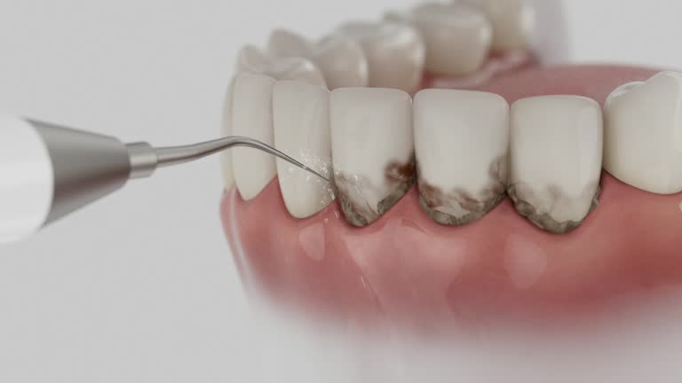 Reliable Dental Implants contractor in Kamas, UT by Smile Center Dentistry
